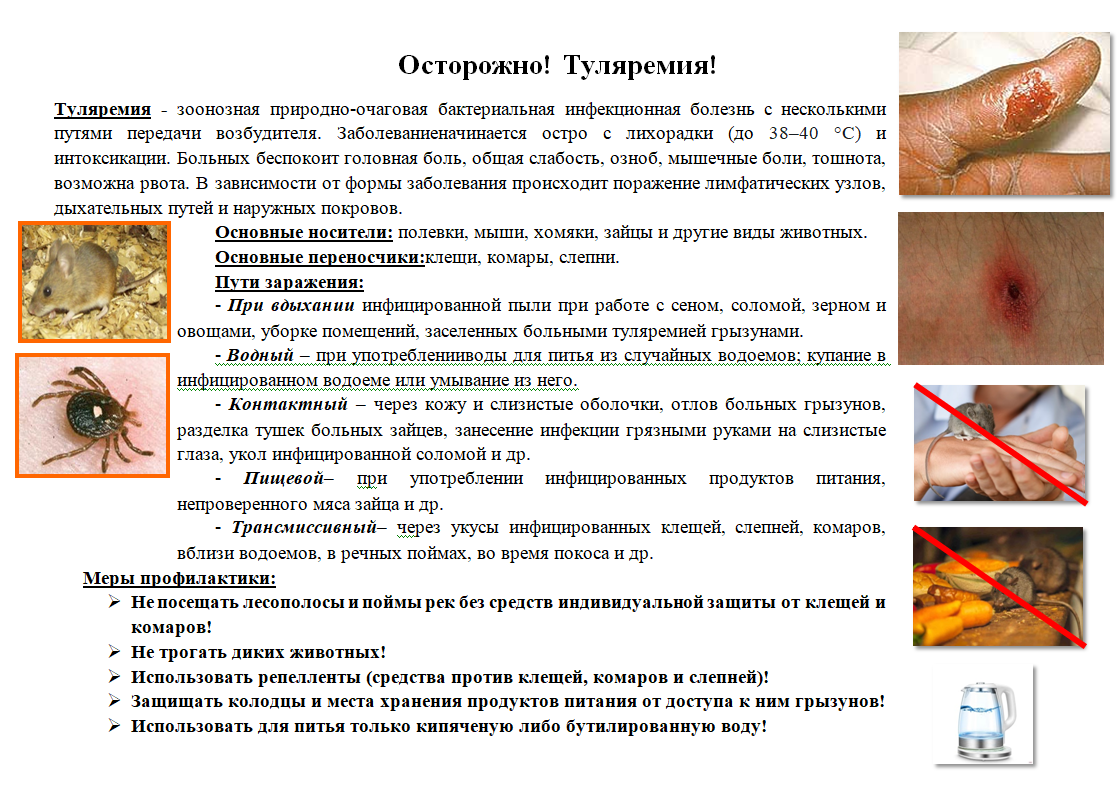 Tulyaremiya 2024 04 09